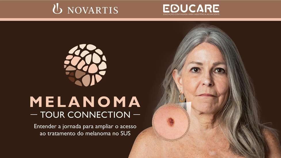 Melanoma – Tour Connection