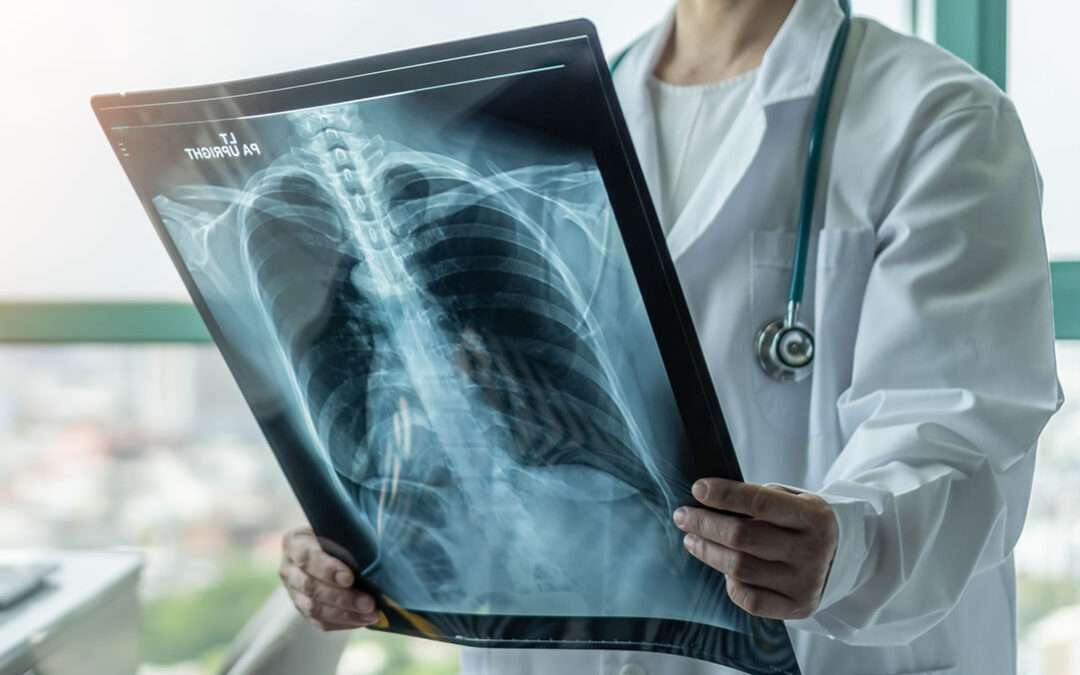 Você precisa conhecer o estudo ADAURA! Especialistas explicam o porquê.